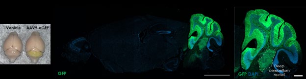 MuriPhys research images showing cerebellar GFP expression after direct cerebellar AAV9-CAG-GFP injection